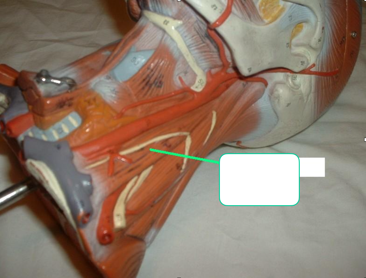 <p>yellow nerve and red x going thru it </p>