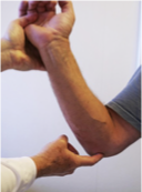 <p>Purpose</p><ul><li><p>Assess for cubital tunnel syndrome/ulnar nerve compression </p></li></ul><p>Position</p><ul><li><p>Sitting or standing</p></li></ul><p>Technique</p><ul><li><p>Examiner locates the ulnar nerve between the olecranon process and the medial epicondyle </p></li><li><p>Examiner repeatedly taps or percusses the trapped nerve with index finger or middle finger </p></li></ul><p>Interpretation</p><ul><li><p>(-): patient experiences no pain, numbness, or tingling </p></li><li><p>(+): patient experiences pain, numbness, or tingling in the ulnar nerve distribution along the forearm and/or hand associated with the tapping/percussing suggestive of cubital tunnel syndrome </p></li></ul><p></p>