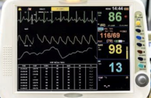 <p>Standard Clinical Monitor Display</p>