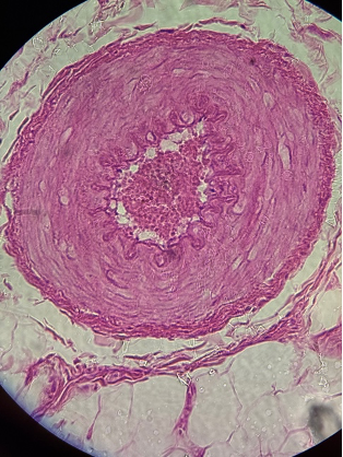 term image