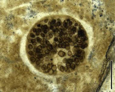 <p>aseptate hyphae; phyla of fungi; mutualistic; arbuscular mycorrhizae(inside root cells); lack of sexual and asexual reproductive structures (has genes for them but structures have never been observed)</p>