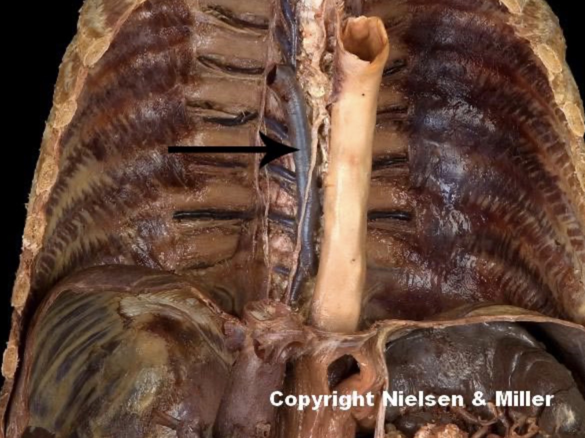 <p>The indicated vessel is the _. The indicated vessel drains the _ side of the thoracic wall, thoracic _, and posterior abdominal wall</p>