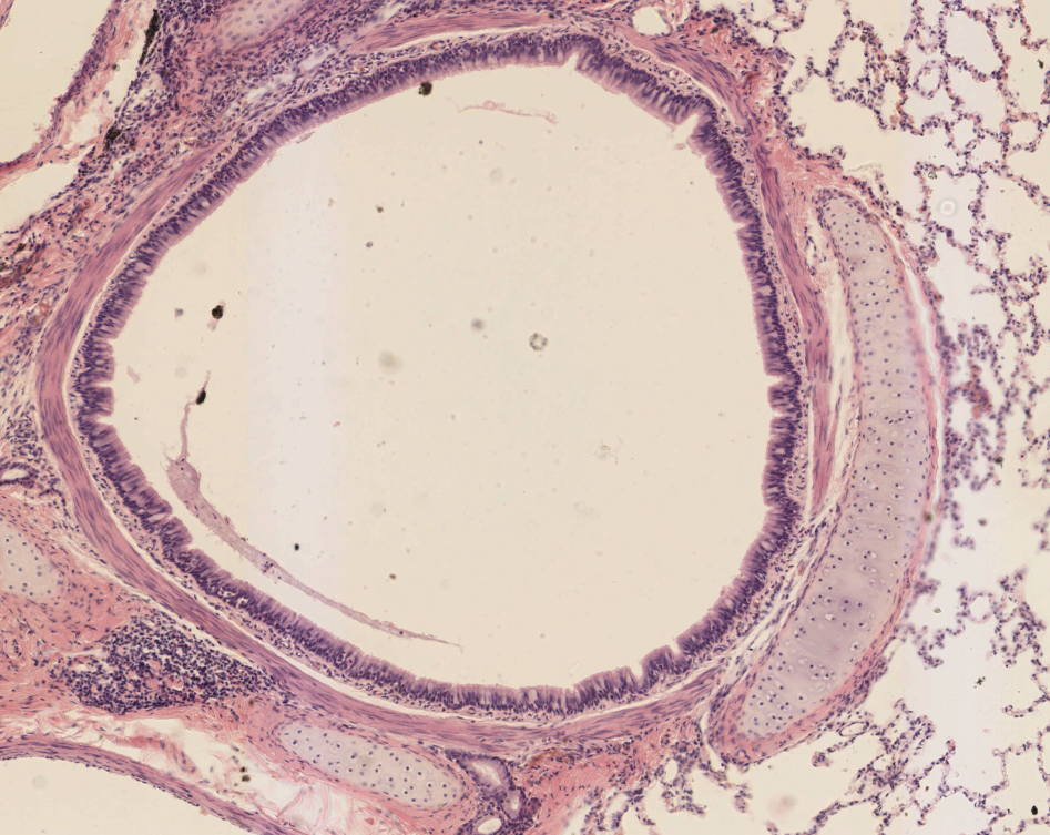 <p>Tejido que se encuentra <span style="color: rgb(63, 196, 18);">presente</span> en traquea y en los bronquios pero está <span style="color: red;">ausente</span> en los bronquiolos terminales, <strong>proporciona rigidez y soporte estructural para el epitelio:</strong></p>