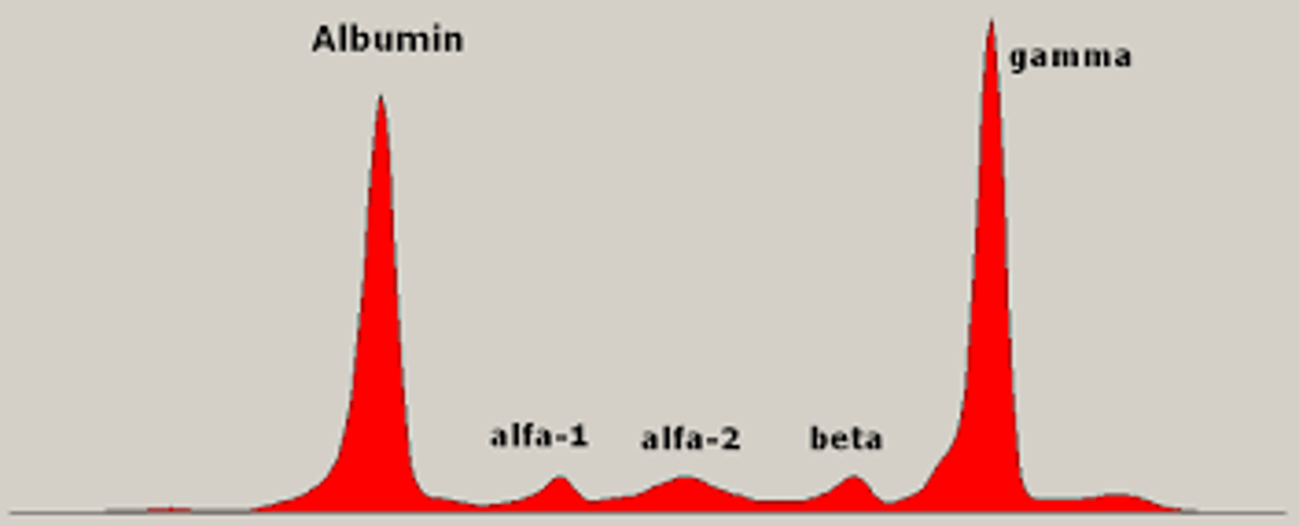 <p>Protein electrophoresis (M-spike), N/N anemia, pancytopenia (low PLT, RBC & WBC); rouleaux; BM biopsy >30% plasma cells</p>