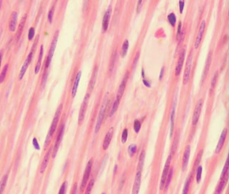 <p>What type of muscle is shown on this histology?</p>