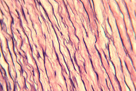 <p>which type of connective tissue is this?</p>
