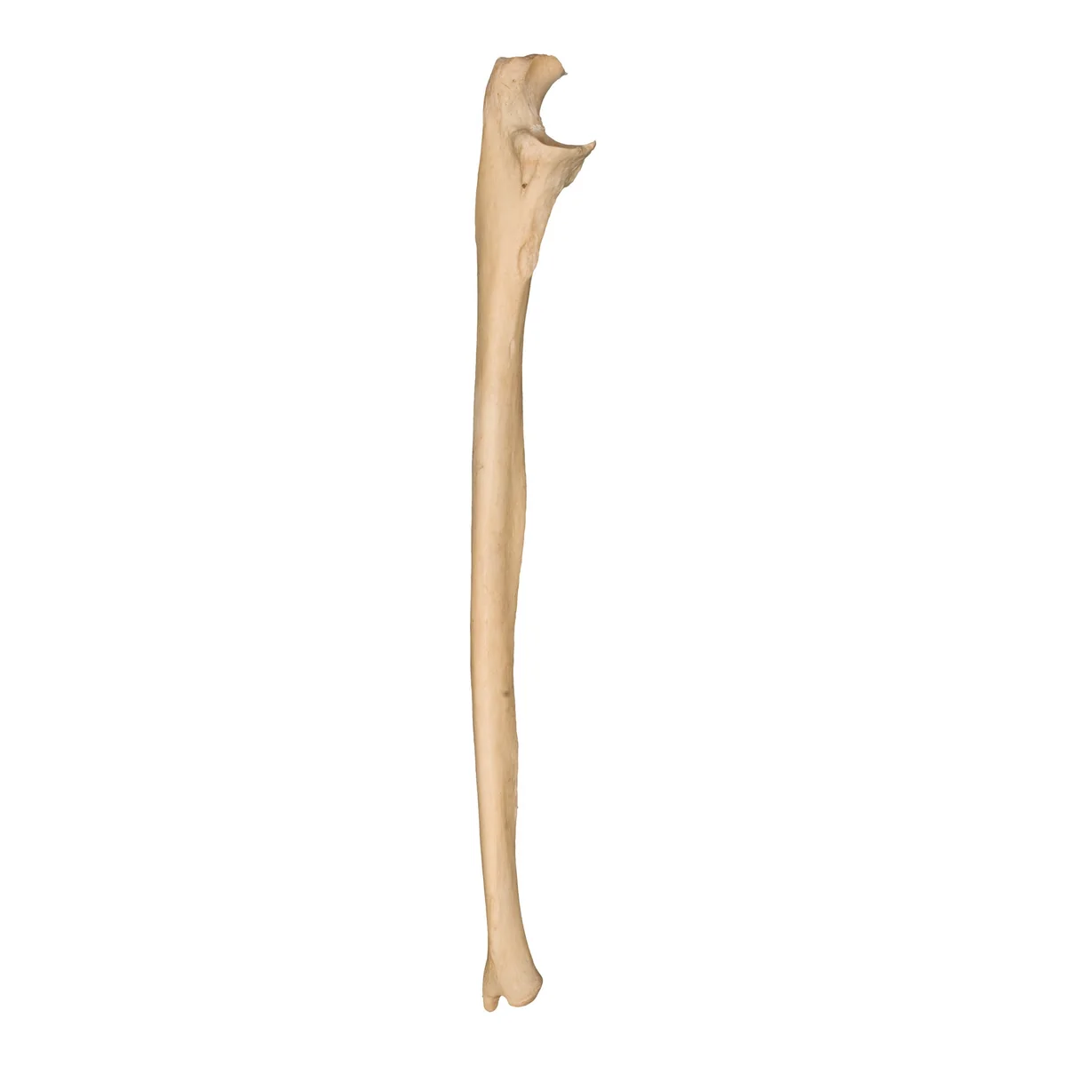 <p>What bone is this?</p>