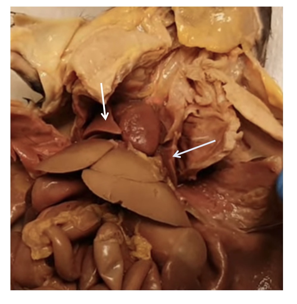 <p>name the organ at the pointer tip</p>