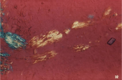 <p>pyrophosphate crystals </p>