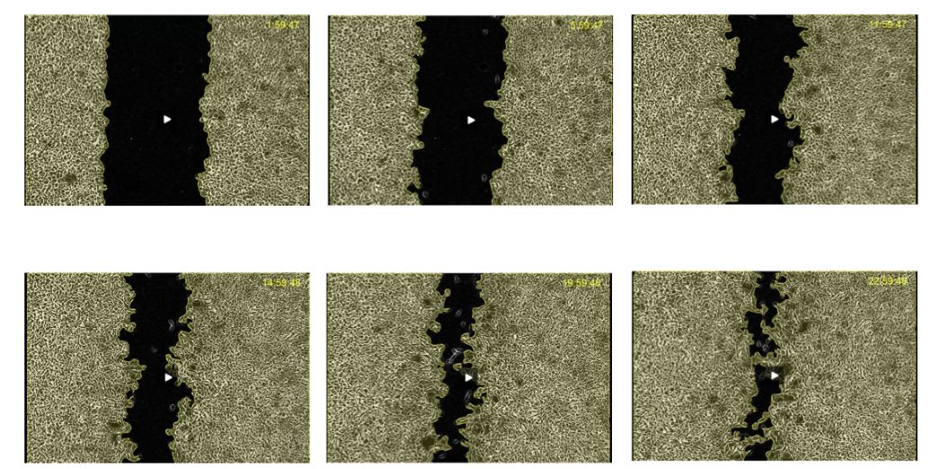 <p>a motility assay</p><p><span style="background-color: inherit; line-height: 22px; color: windowtext;">Cancer cells growing in culture on well</span><span style="line-height: 22px; color: windowtext;"> </span></p><ul><li><p class="Paragraph SCXO37630217 BCX0" style="text-align: left;"><span style="background-color: inherit; line-height: 22px; color: windowtext;">Allow to cover whole dish</span><span style="line-height: 22px; color: windowtext;"> </span></p></li><li><p class="Paragraph SCXO37630217 BCX0" style="text-align: left;"><span style="background-color: inherit; line-height: 22px; color: windowtext;">Scratch a wound into cell layer- gap between cells</span><span style="line-height: 22px; color: windowtext;"> </span></p></li><li><p class="Paragraph SCXO37630217 BCX0" style="text-align: left;"><span style="background-color: inherit; line-height: 22px; color: windowtext;">Use microscopes, measure how cells will migrate to fill in the gap </span><span style="line-height: 22px; color: windowtext;"> </span></p></li><li><p class="Paragraph SCXO37630217 BCX0" style="text-align: left;"><span style="background-color: inherit; line-height: 22px; color: windowtext;">Over time, gap fills as cells migrate </span><span style="line-height: 22px; color: windowtext;"> </span></p></li><li><p class="Paragraph SCXO37630217 BCX0" style="text-align: left;"><span style="background-color: inherit; line-height: 22px; color: windowtext;">Put conditions/drugs into environment to see how can modulate cells to be more or less motile </span><span style="line-height: 22px; color: windowtext;"> </span></p></li></ul><p></p>