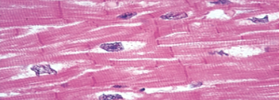 <p>Slide 45</p>