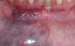 <ol start="37"><li><p>Identify the finding shown.</p></li></ol><p></p>