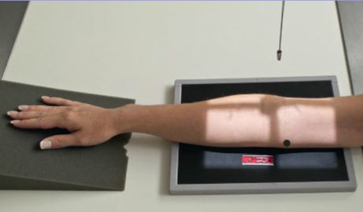 <p>S - on lap</p><p>T - 6 mAs @ 60 kVp</p><p>A - none</p><p>M - correct arm, on cassette</p><p>P - 45 degree rotation medially, CR mid elbow</p><p>S - 40"</p><p>B - hold</p><p>C - 10 by 12, L</p>