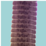 <ul><li><p>body of dwarf tapeworm <em>Hymenolepis nana</em><span> strobila</span></p></li><li><p>Hymenolepiasis</p></li></ul><p></p>