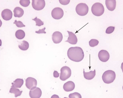 <p>name the type of RBC</p>