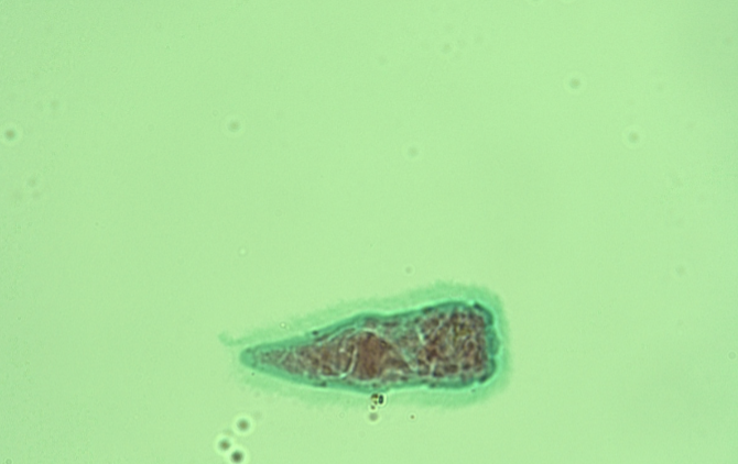 <p>Whats the name of this fluke?</p>