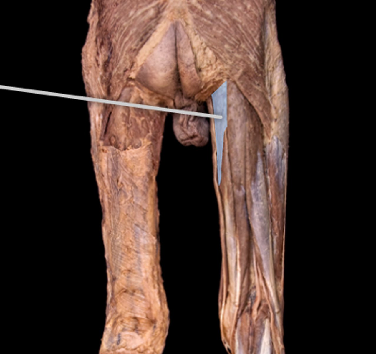 <p>What muscle is this?</p>