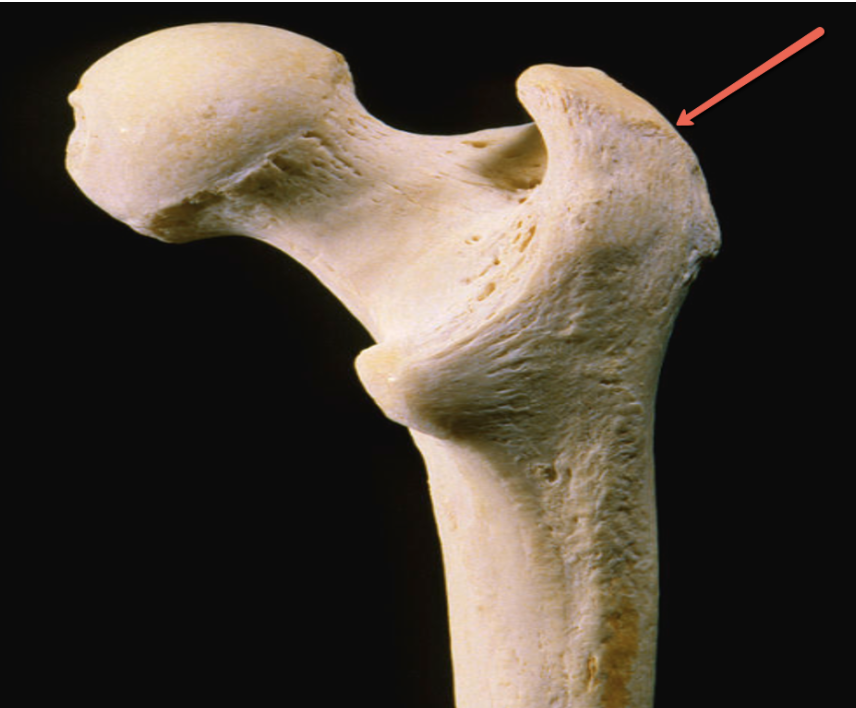 <p><strong>Identify the bone marking indicated by the pointer.</strong></p>
