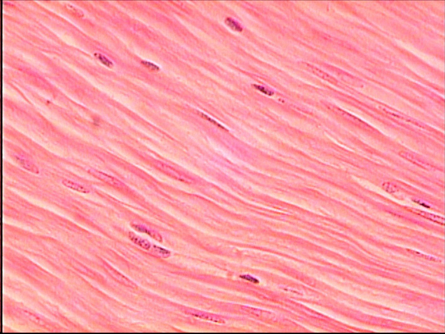 <p>The complete muscle organ made up of thousands of bundled muscle fibers</p>
