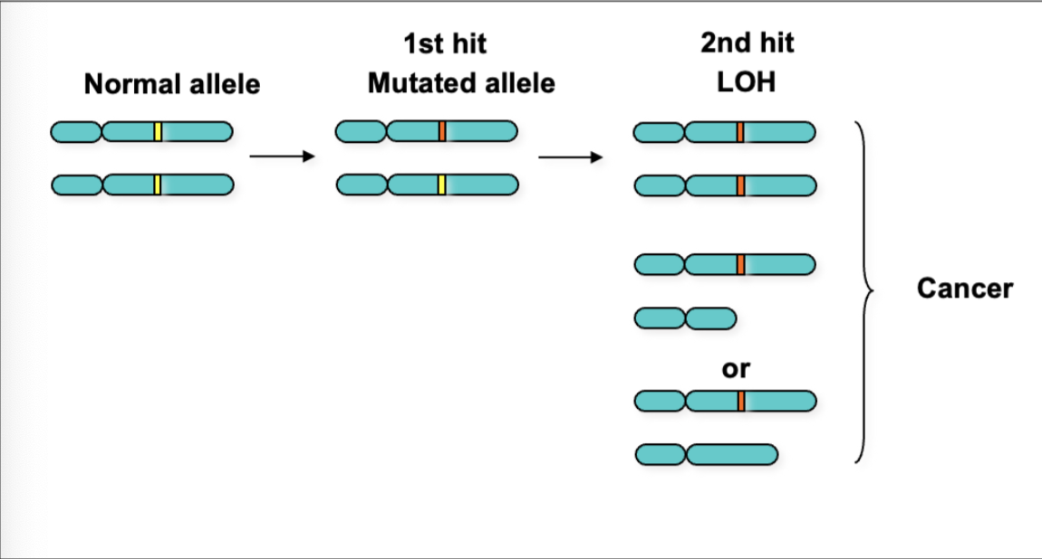 <p>Represent the loss of functional expression of one allele of a gene in which the other allele was already inactivated. </p><ul><li><p>includes deletions, mutations and epigenetic silencing </p></li></ul><p><em>Rb, 2-hit hypothesis (LOH)</em></p><p>Familial cases are more likely to develop bilateral/multifocal tumours</p><ul><li><p>familial and bilateral cases have earlier onset - first ‘hit’ occurs in gremlin</p></li><li><p>sporadic involves a single focus of tumour in 1 eye - both ‘hits’ postulated to ve in same somatic cell for oncogenic transformation</p></li></ul><p></p>