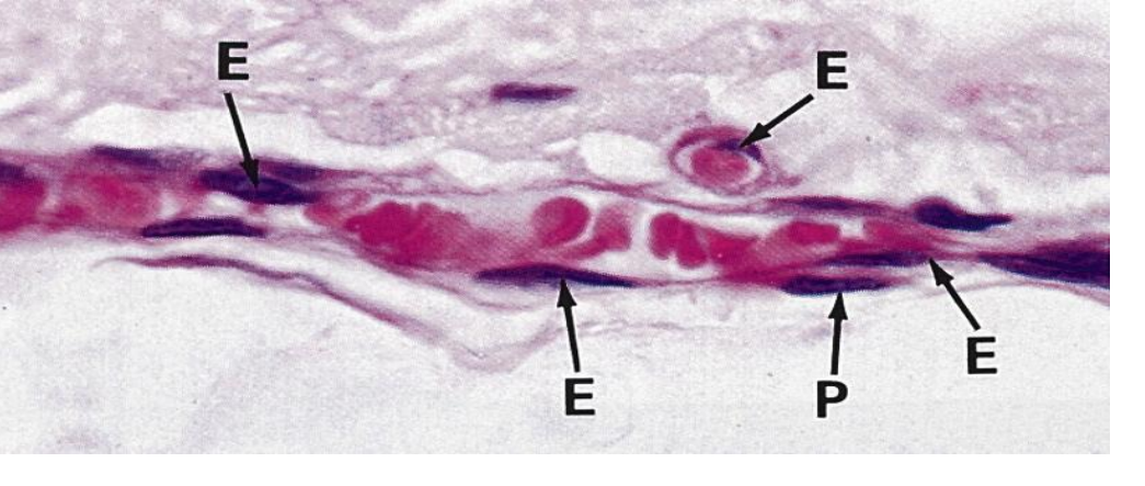 <p>Identify this vessel</p>