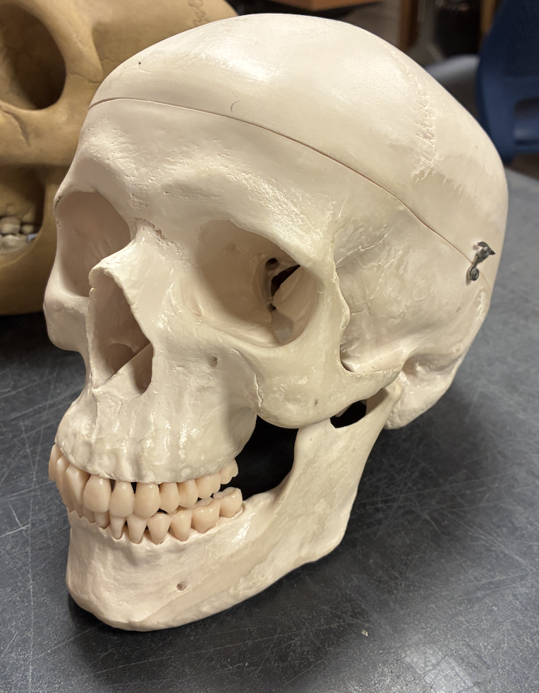 <ul><li><p>large brain size (1300-1500cc)</p></li><li><p>rounded skull with high forehead</p></li><li><p>small face and jaw</p></li><li><p>reduced brow ridge</p></li><li><p>flat face with less projection</p></li></ul><p></p>