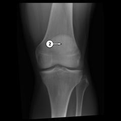 <p>2?</p>