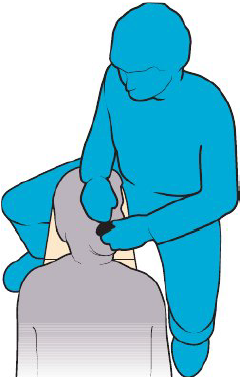 <p><strong>Torso position</strong></p><ul><li><p>Top left corner of headrest</p></li><li><p>Midline of torso — left temple region of patient’s head</p></li></ul><p><strong>Leg position</strong></p><ul><li><p>Straddle corner of headrest</p></li></ul><p><strong>Arm positions</strong></p><ul><li><p>Left hand directly across corner of patient’s mouth</p></li><li><p>Right hand and wrist above patient’s nose and forehead</p></li></ul><p><strong>Line of vision</strong></p><ul><li><p>Straight ahead into patient’s mouth</p></li></ul><p></p>