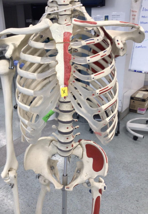 <p>The xiphoid process is the inferior part of which bone?</p>