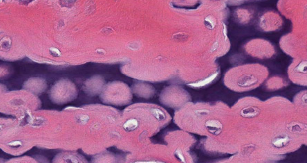 <p>What stains pink in this slide? What stains blue in this slide? (Dog Humerus)</p>