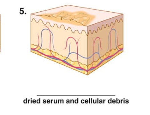 <p>dried serum and cellular debris</p>