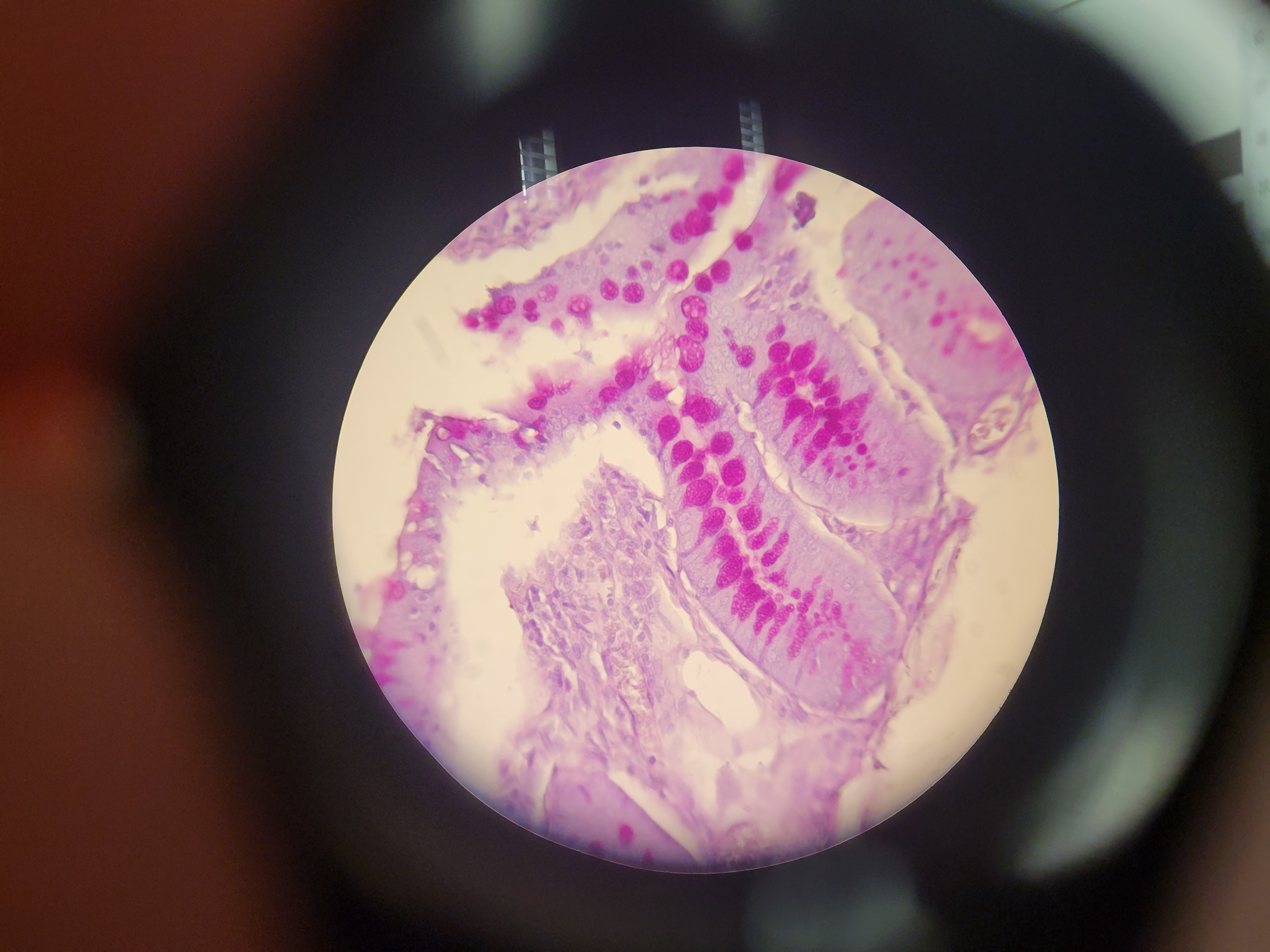 <p>What organ is this? What type of cells are down</p>