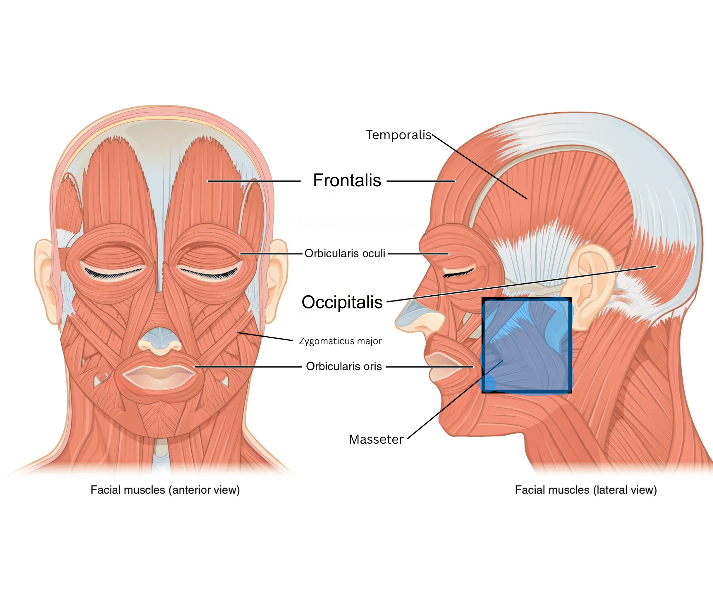 <p><span style="background-color: transparent;">Frontalis — raises eyebrows/wrinkles forehead, sits superficial to (on top of) the frontal bone. </span></p><p><span style="background-color: transparent;">Occipitalis — works with frontalis to move the scalp. Zygomaticus major — pulls mouth corners up (smiling). </span></p><p><span style="background-color: transparent;">Orbicularis oris — closes/puckers the lips. </span></p><p><span style="background-color: transparent;">Orbicularis oculi — closes the eyelids. </span></p><p><span style="background-color: transparent;">Masseter — closes the jaw for chewing.</span></p><p><span style="background-color: transparent;"> Temporalis — closes the jaw for chewing, sits superficial to (on top of) the temporal bone.</span></p><p><br></p>