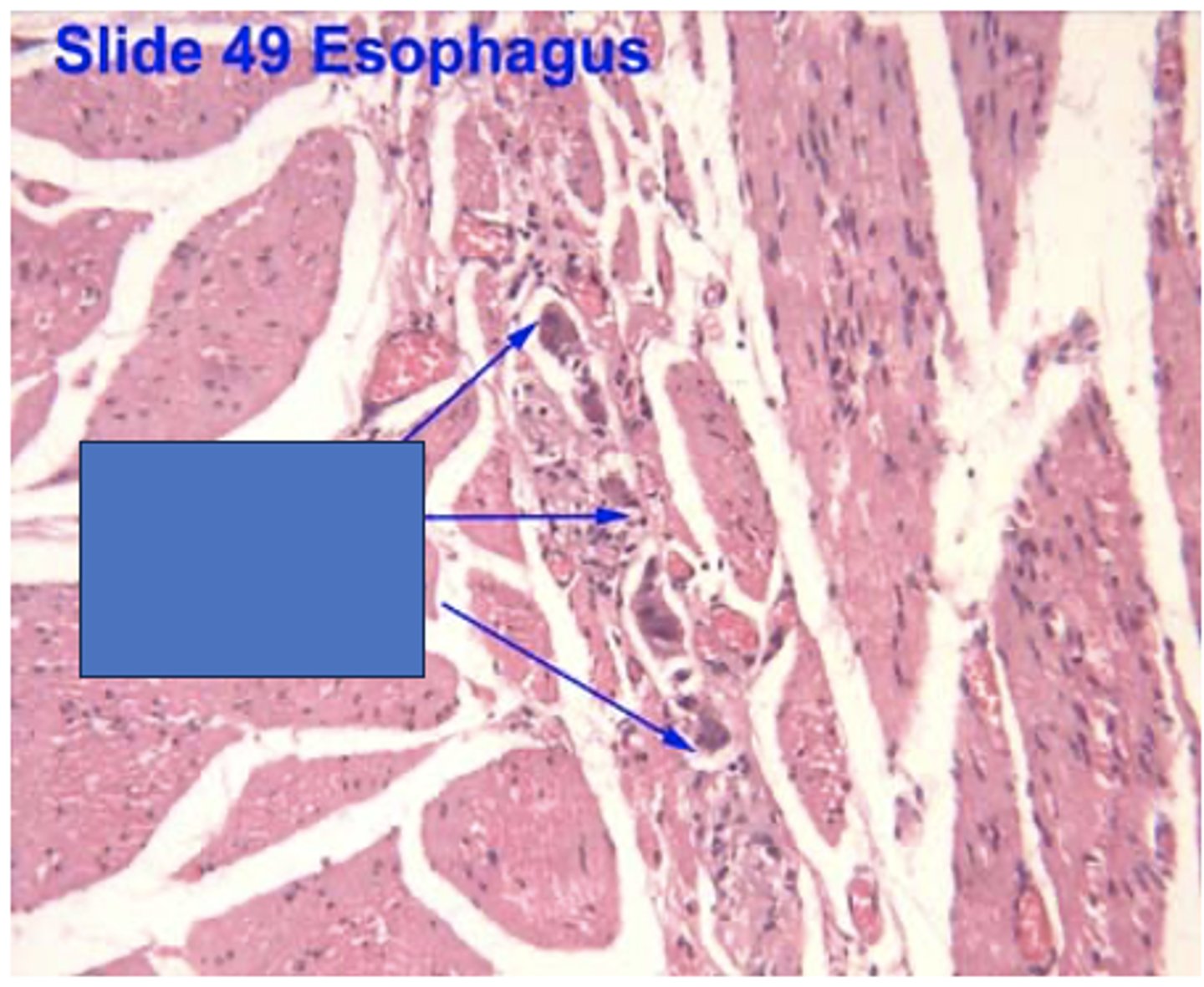 <p>Identify the structure</p>