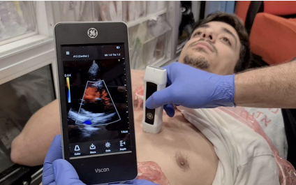 <p>Emergency Focused Assessment with Sonography for Trauma</p><p>Used to look for: </p><ul><li><p>Pericardial effusion and cardiac tamponade</p></li><li><p>Pneumothorax</p></li><li><p>Haemothorax </p></li><li><p>Internal bleeding </p></li></ul><p></p>