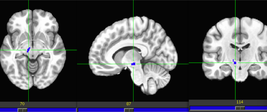 term image