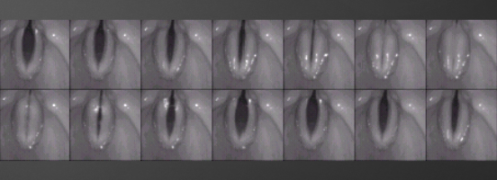 <p>what does this show and how is it conducted</p>