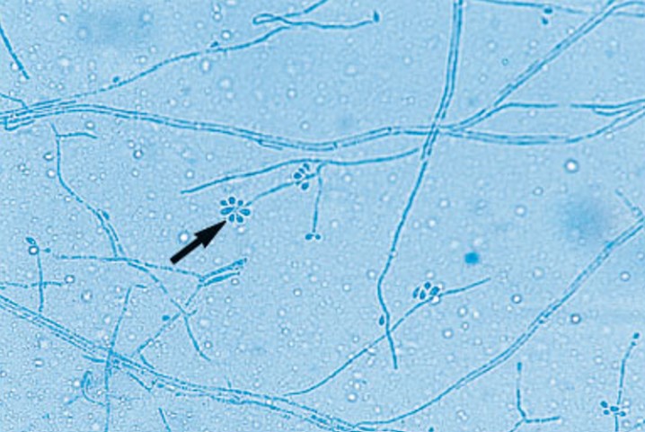 <p>Name</p>