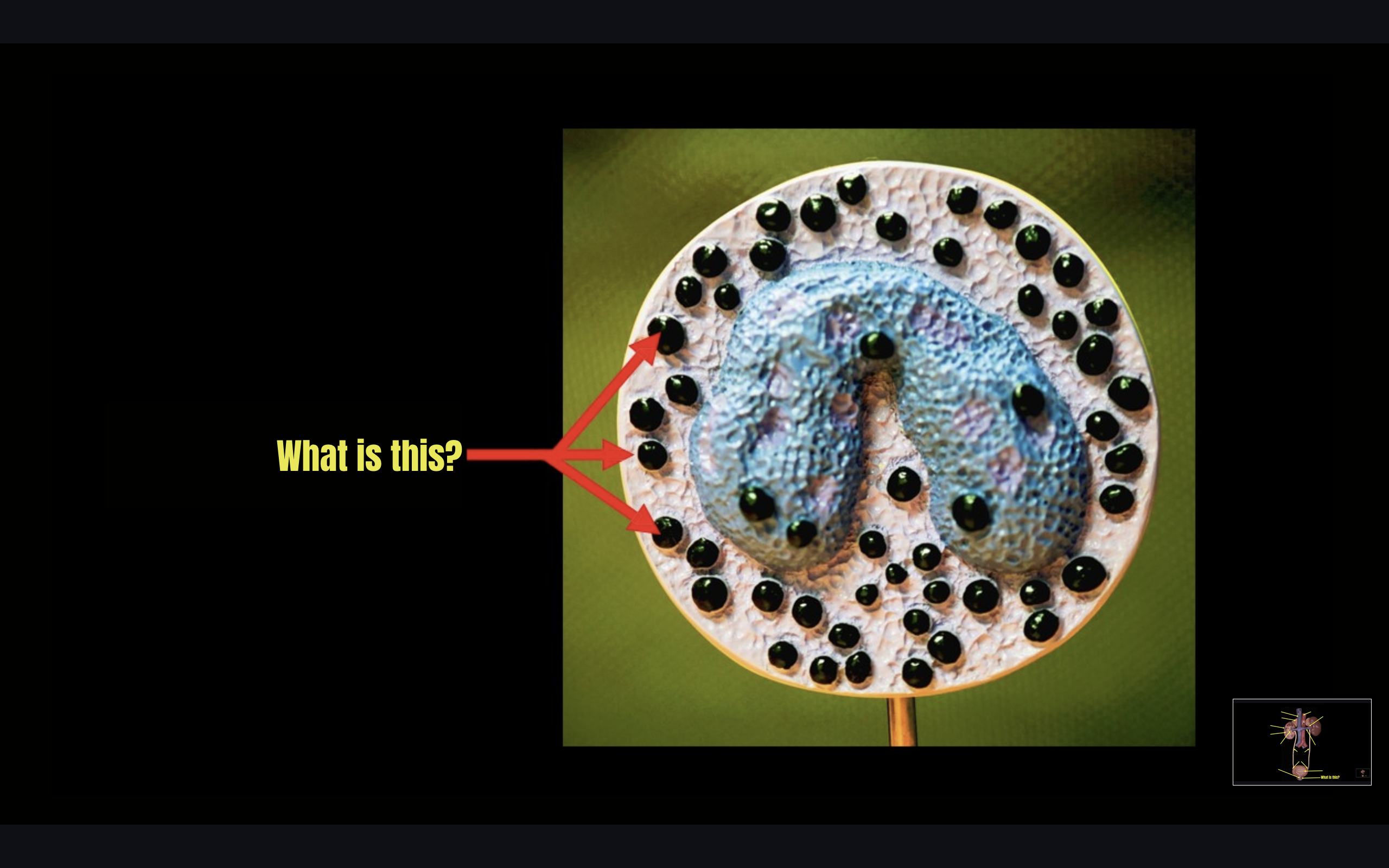 term image