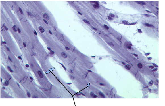 <p>What kind of muscle is this</p>