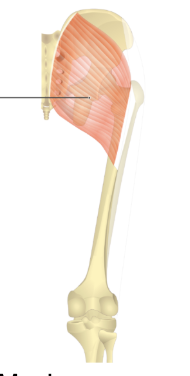 term image