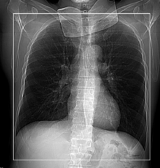 <p>Start location: Just above lung apices End location: Just below costophrenic angles</p>