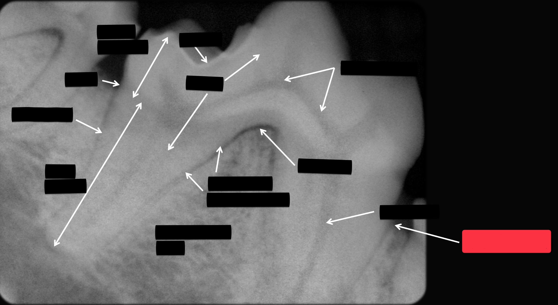 <p>Label this part of the tooth.</p>