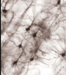 <p>sparsely stains entire<strong> individual neurons</strong> (dendrites, cell body, axons)</p>