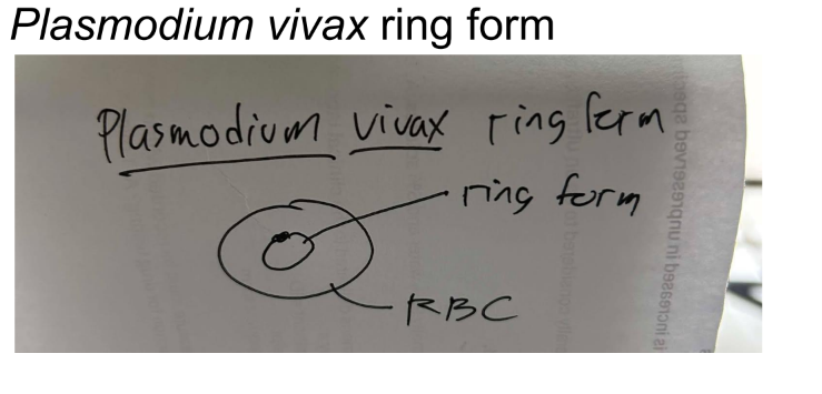 <p>Plasmodium vivax ring form daw</p>