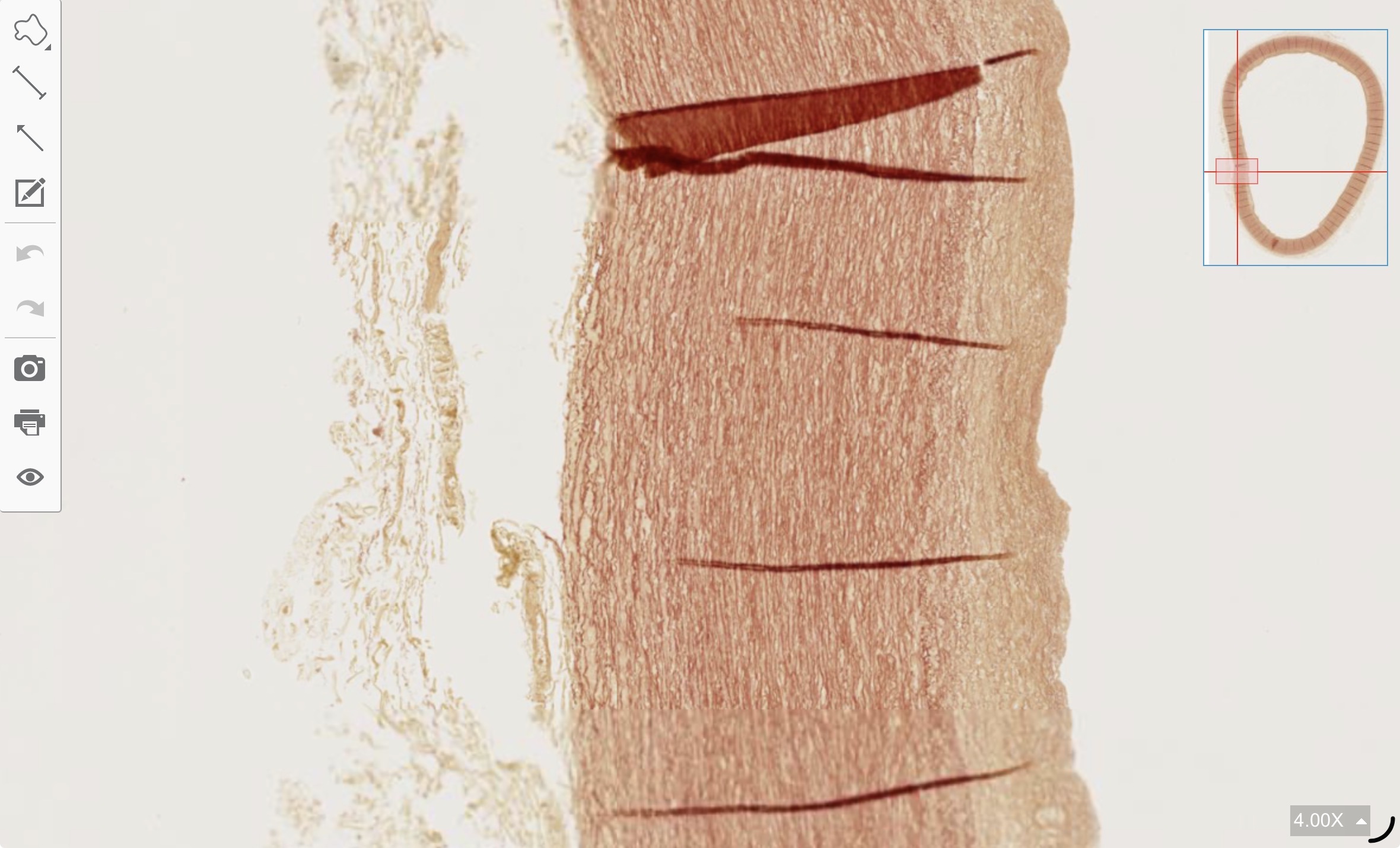 term image