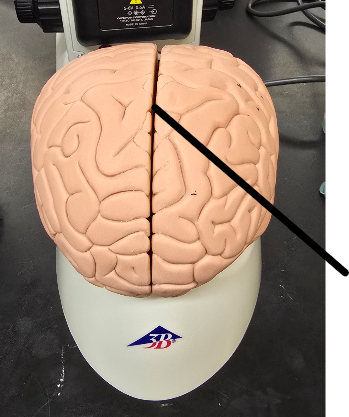 <p>Name Region/Part of Brain, Be Specific</p>