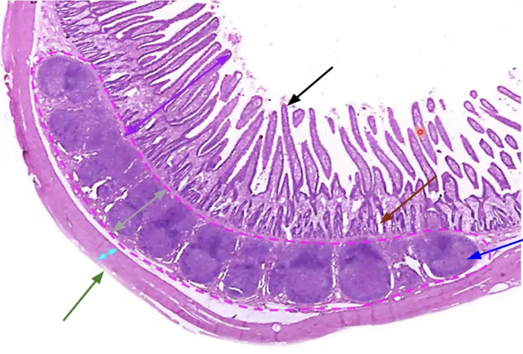 <p>What organ is this? Identify What is function of pink?</p>
