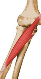 <p>What muscle is being shown?</p>