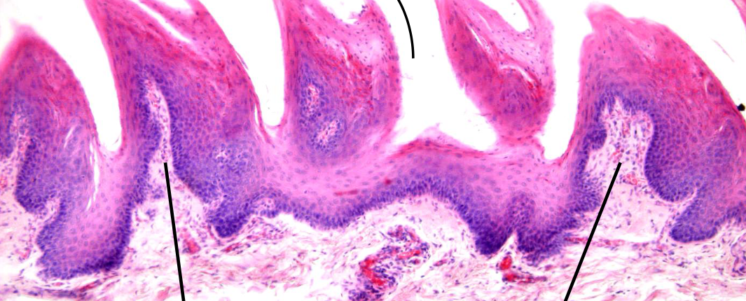 <p>soort epitheel</p>